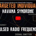 Targeted Individuals & Havana Syndrome by Pulsed Radio Frequency.